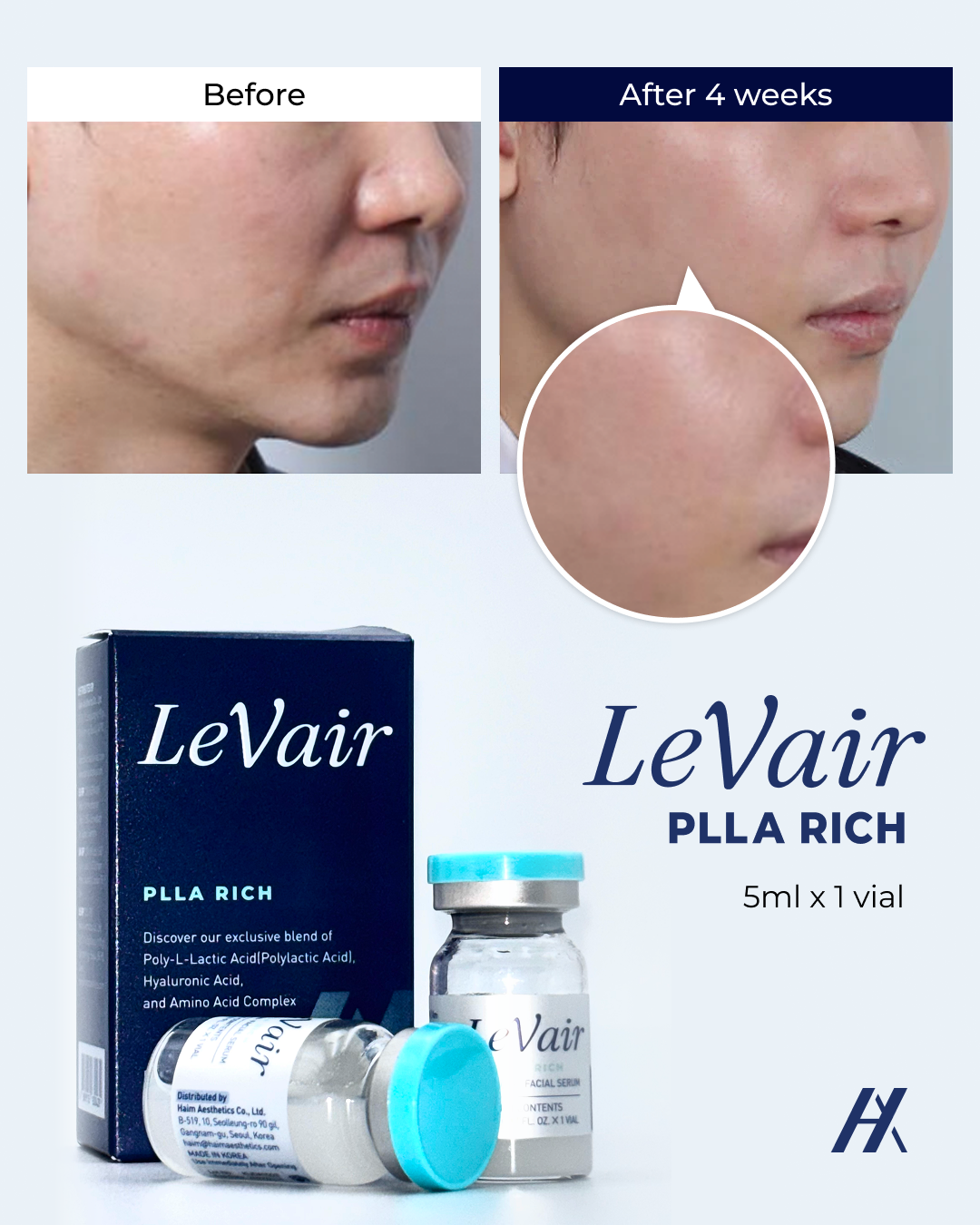 Get a Collagen Training For Your Skin with the LeVair PLLA Rich!