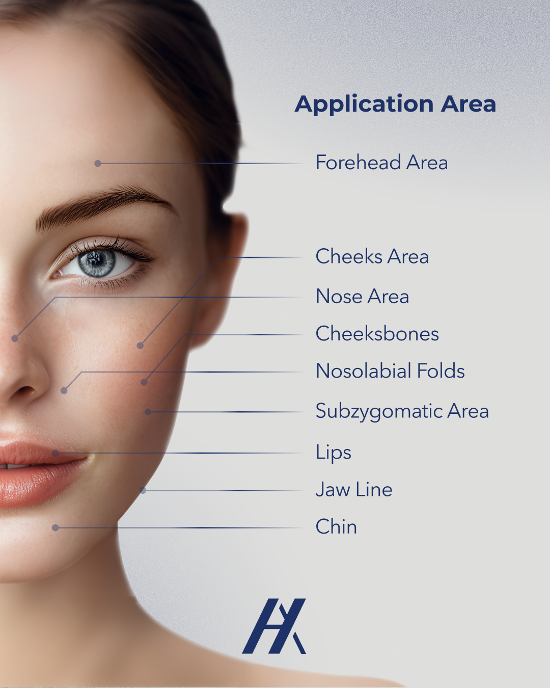 💉Eloquence 1.1mL Typical Injection Areas